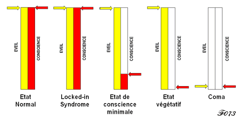 les états altérés de la consience