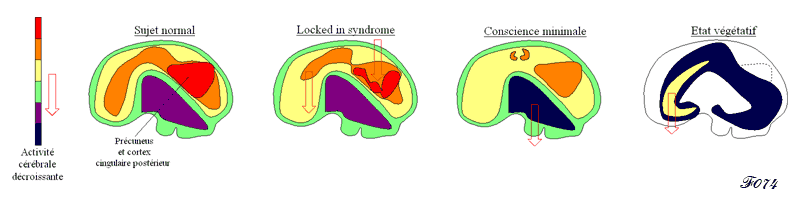 états normaux ou altérés de la consience