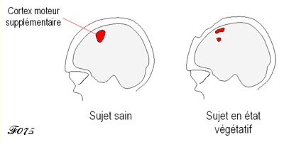 activation du cortex moteur supplémentaire