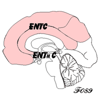 cerveau et espace de travail conscient