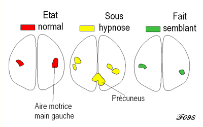 activation du cortex sous hypnose