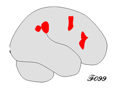 cerveau et action de l'influence