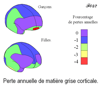 cerveau : pourcentage de perte de neurones