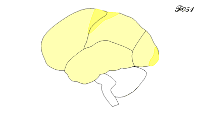 cerveau : developpement de la myeline