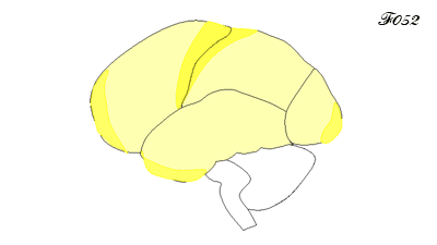 brain: myelin development