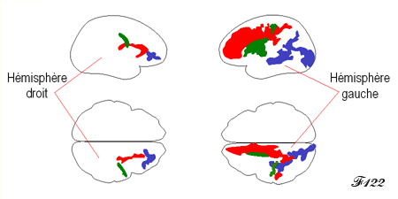 The asymmetric language brain.