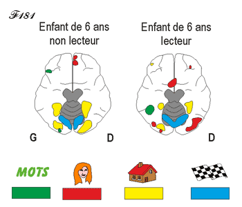 Cerveau chez l'enfant lecteur et non lecteur.