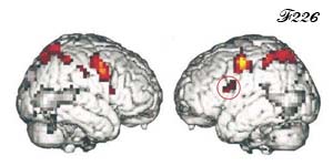 Activated motor areas in the brain.