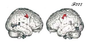 Aires cérébrales activées lors d'une action mimée