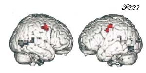 Neurones miroirs activés lors d'une action mimée.