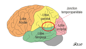 Temporoparietal junction and impaired moral judgements.