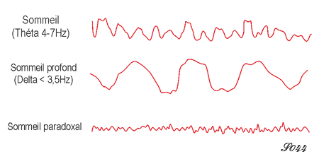 Ondes cérébrales durant le sommeil