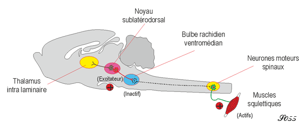 Trouble du comportement en sommeil paradoxal 